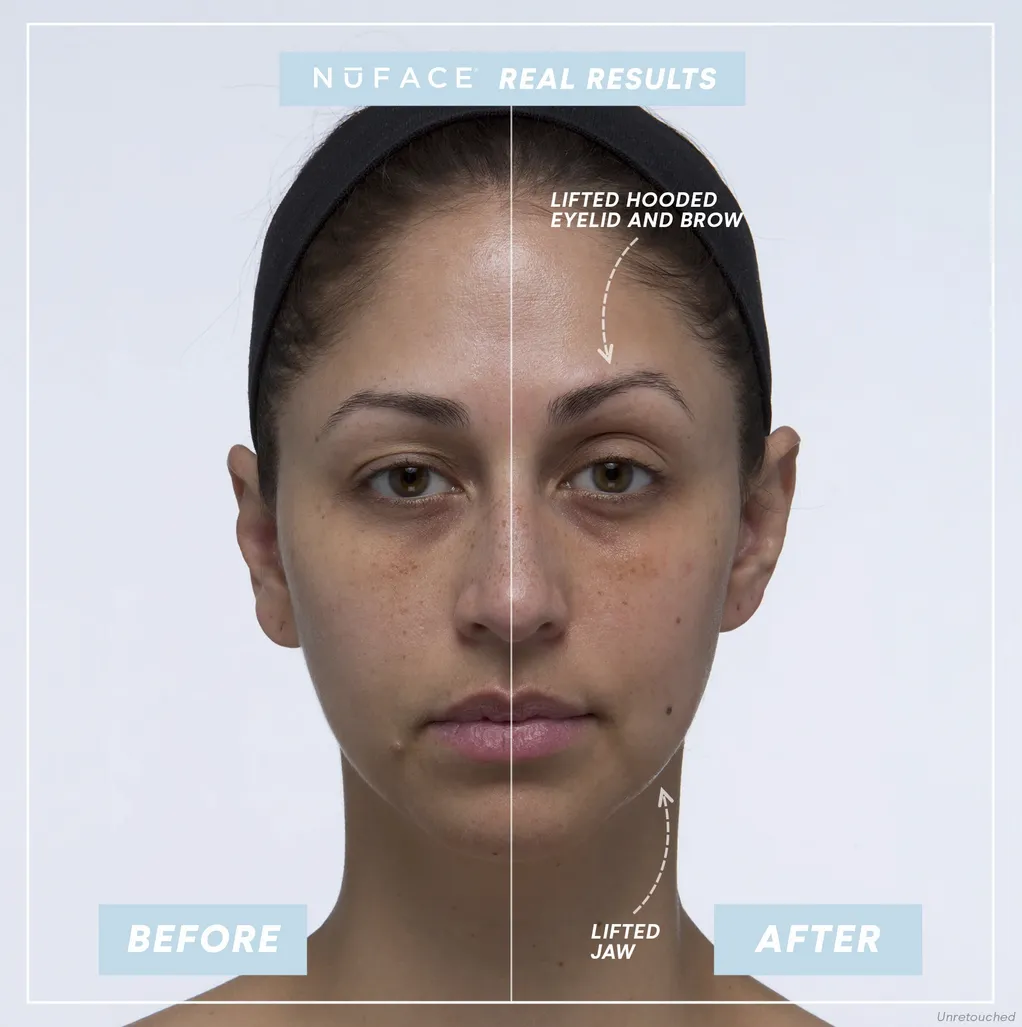 NUFACE Trinity  Pro Smart Device Facial Toning Kit