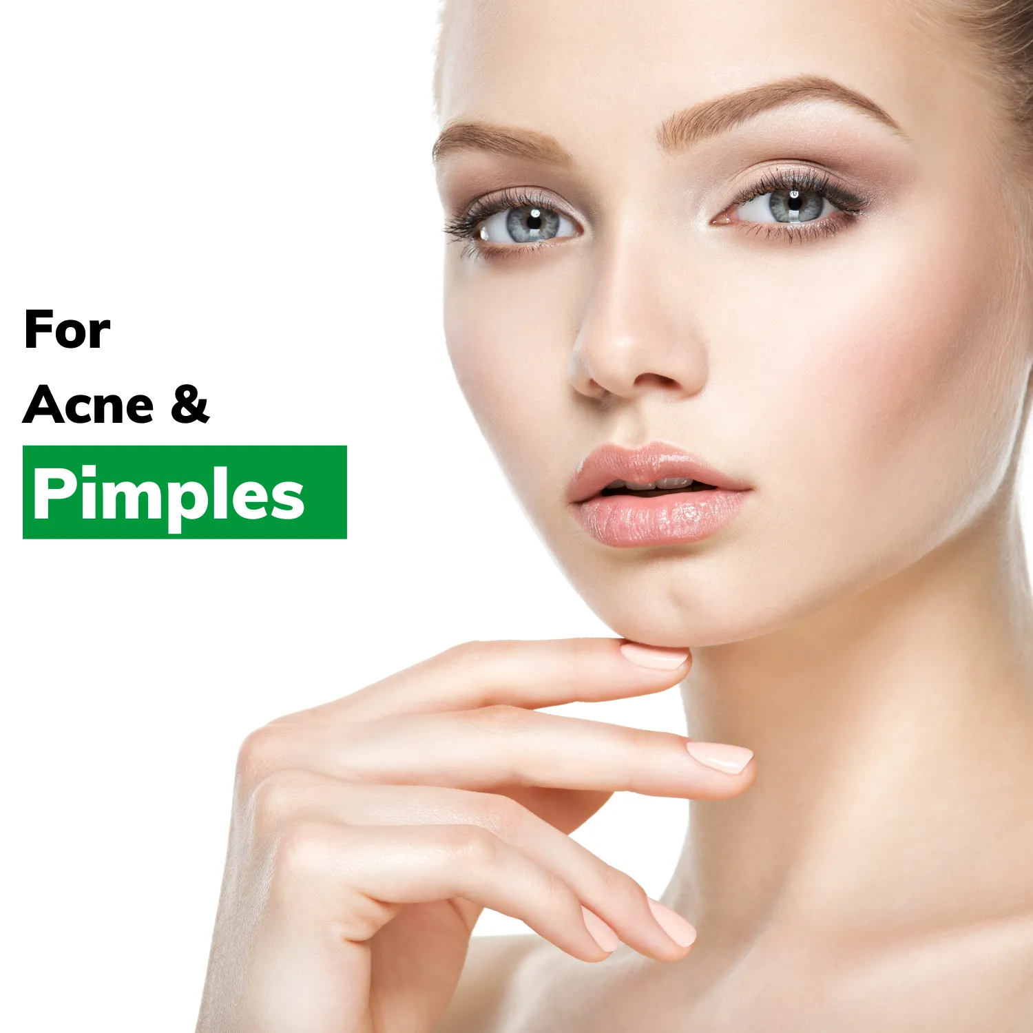 Simple Acne & Pimples Reduction Kit